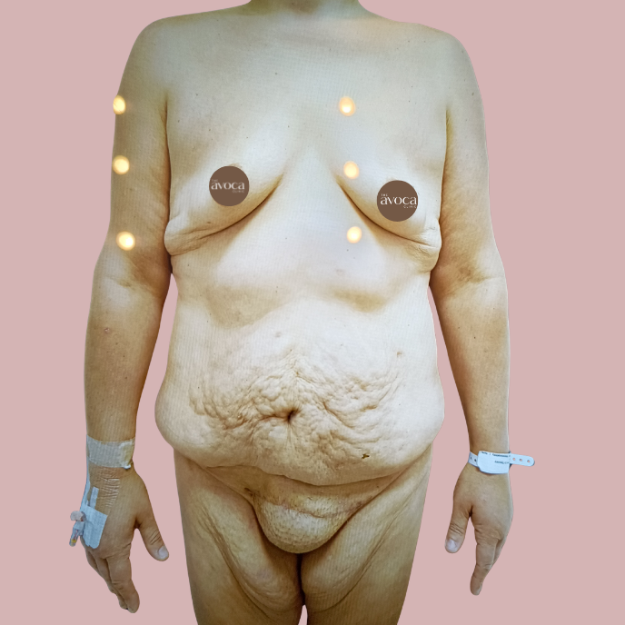 Beforemommymakeover 1