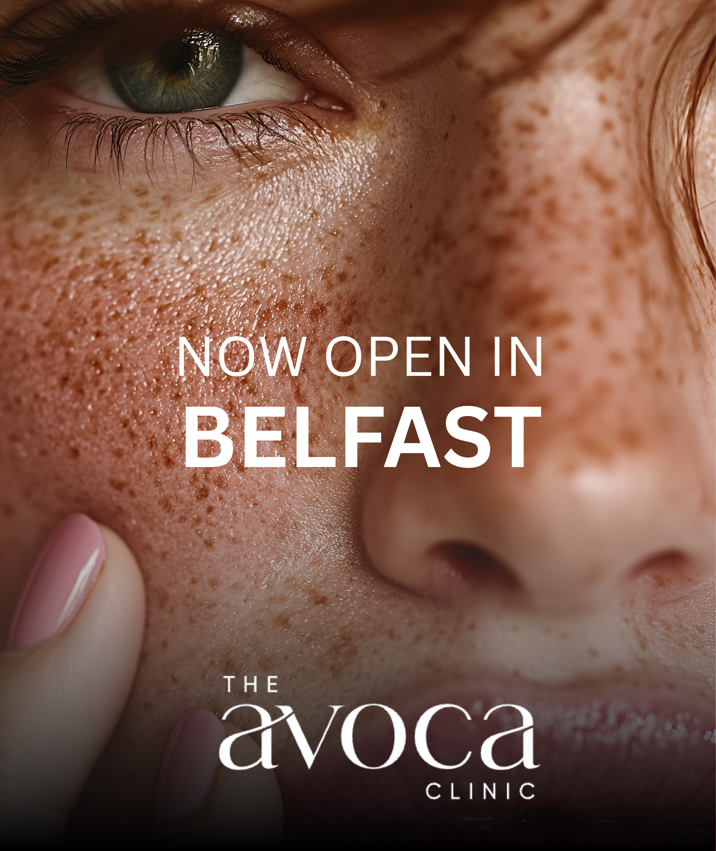 Upper Bleph New Ad Belfast2 1