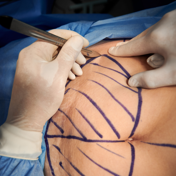 What Is Plastic Surgery The Avoca Clinic Ireland