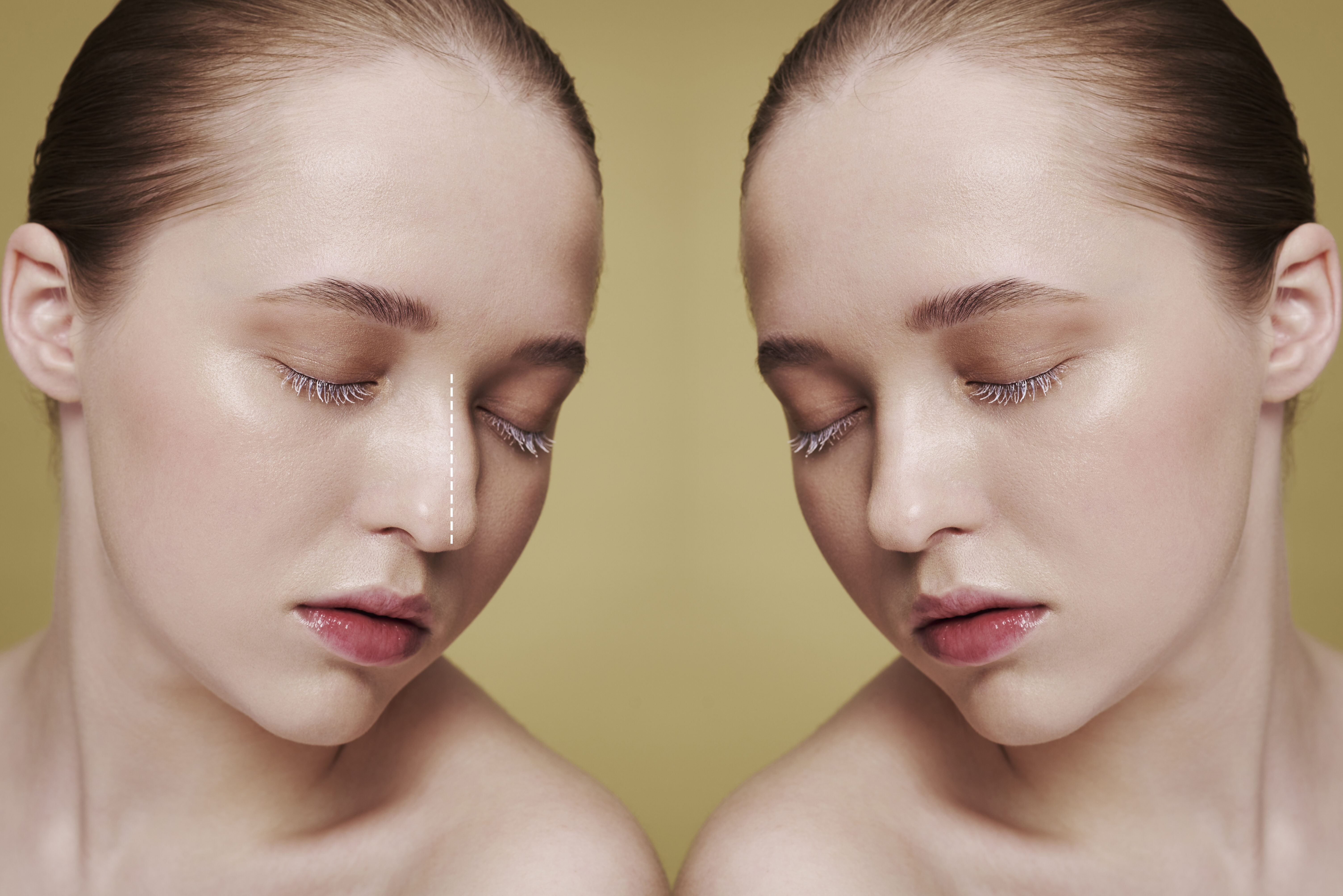 Rhinoplasty surgery concept with woman model 3